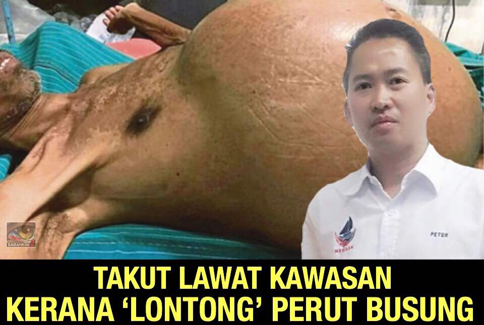 Sihir ‘lontong’ alasan Menteri Warisan takut bertemu rakyat Melalap  
